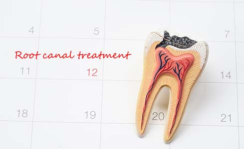 What Is Endodontics and How Can It Help Me?