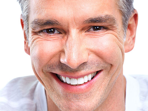 Dental Implants: The Benefits and Overcoming Potential Obstacles