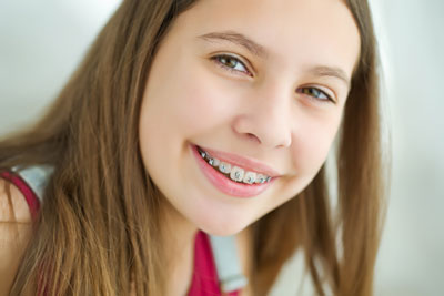 Three Things You Should Know About Orthodontics and Braces